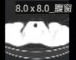 8.0 x 8.0 腹窗缩略图