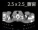 2.5 x 2.5 腹窗缩略图